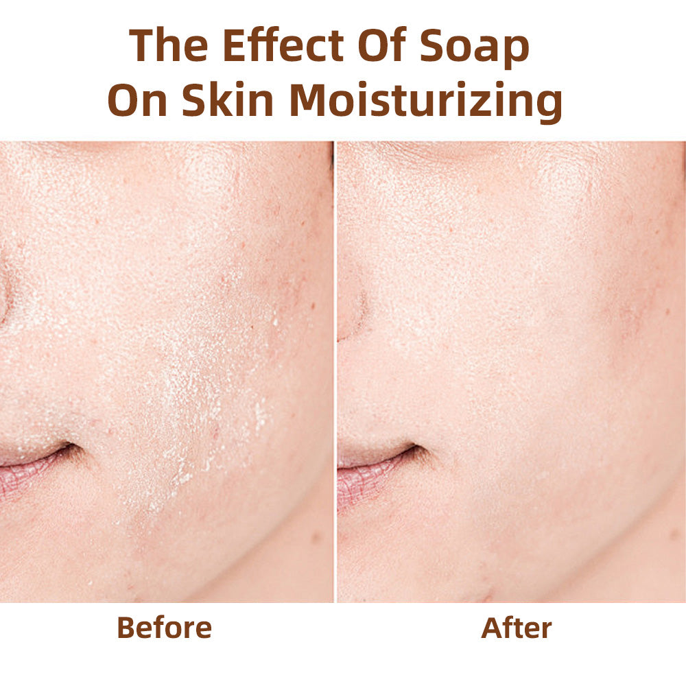 Turcuma Kojic acid Handmade Scrub Soap, 100g