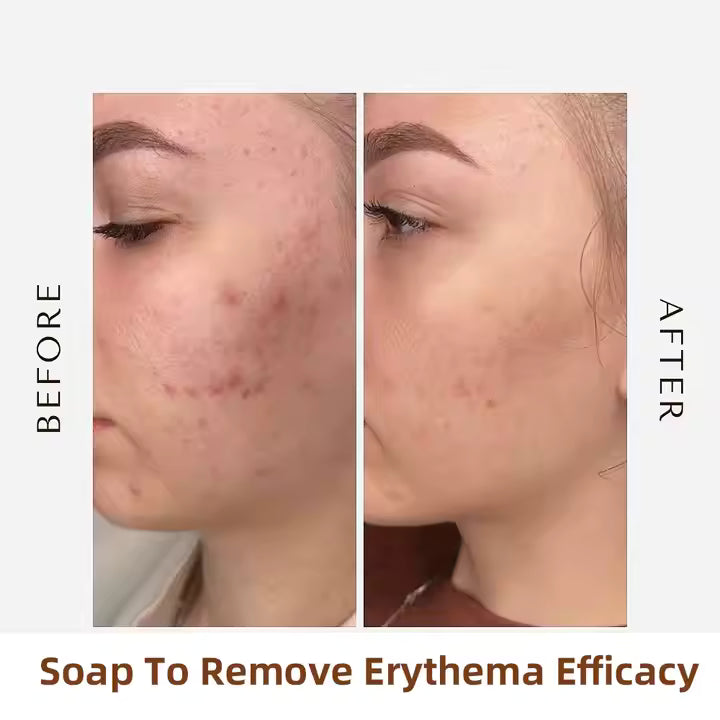 Turcuma Kojic acid Handmade Scrub Soap, 100g