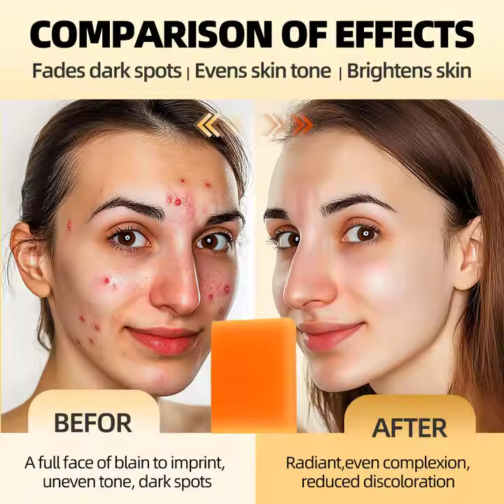 Lemon Kojic acid Handmade Scrub Soap, 100g