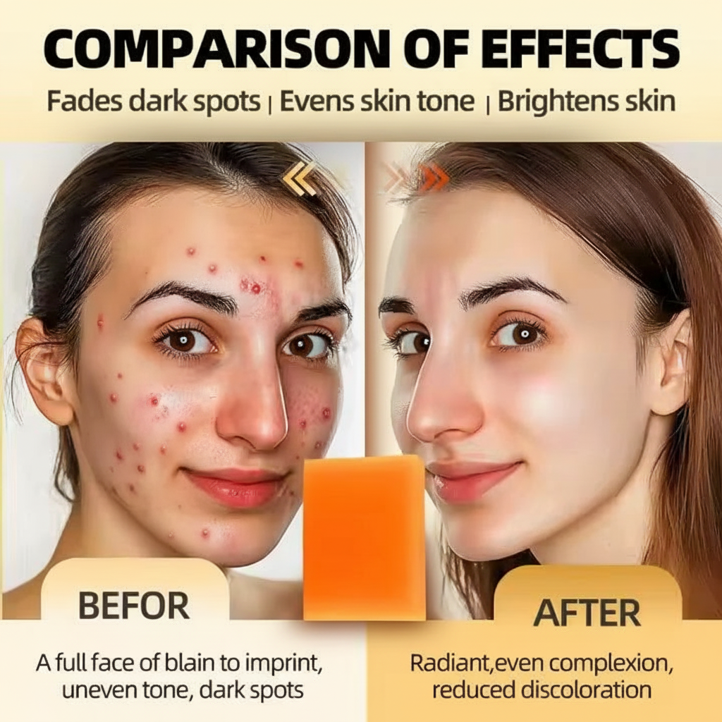 Turcuma Kojic acid Handmade Scrub Soap, 100g